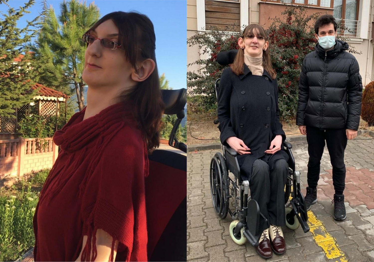 Уникалната история на момиче с рядък синдром, което беше официално признато за най-високото в света